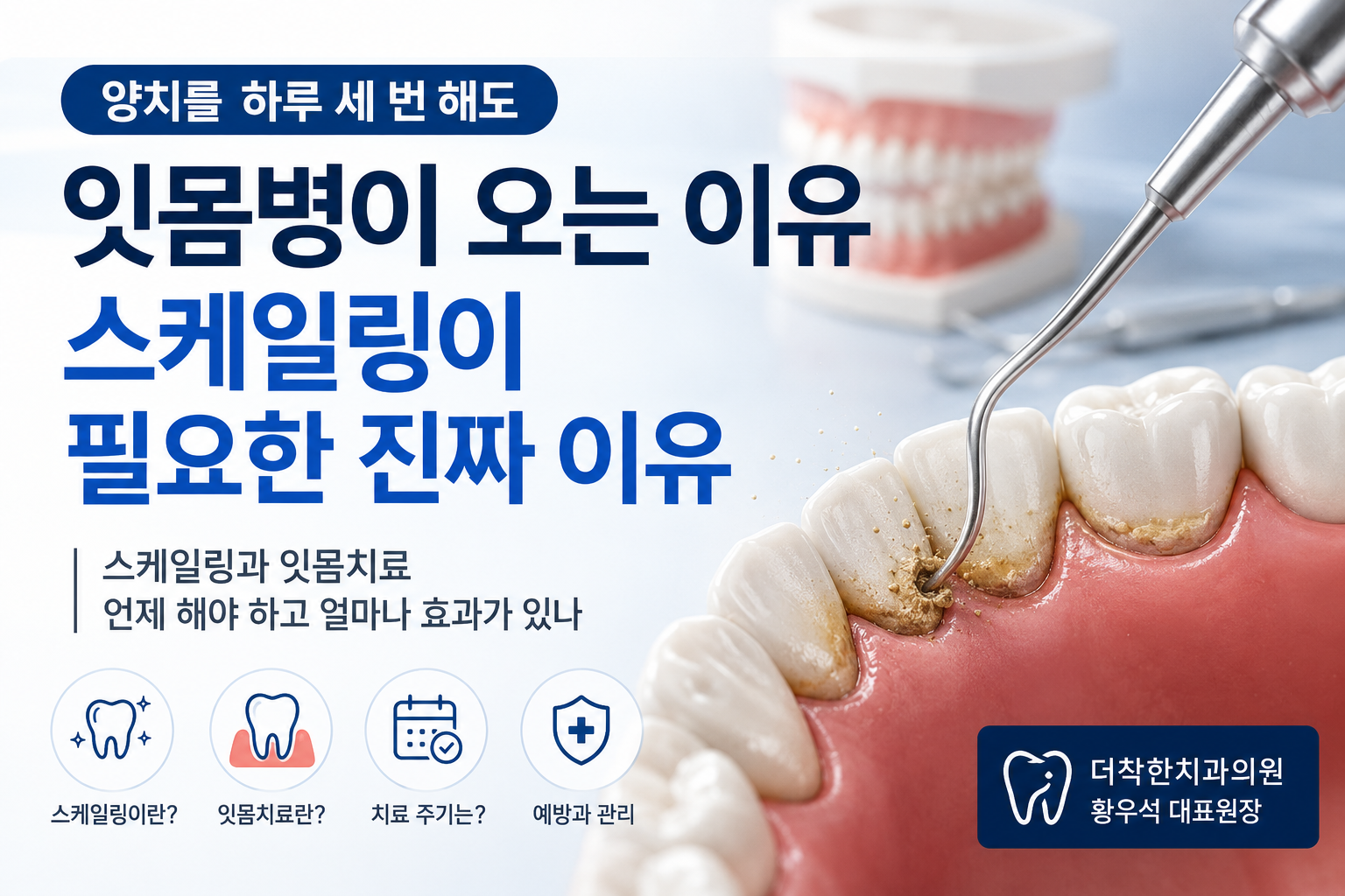 양치를 하루 세 번 해도 잇몸병이 오는 이유 — 스케일링이 필요한 진짜 이유